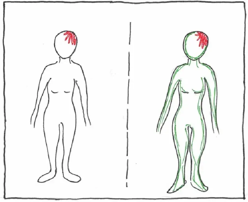 Zwei gezeichnete Figuren nebeneinander wo rechts am Kopf schmerzen dargestellt wird